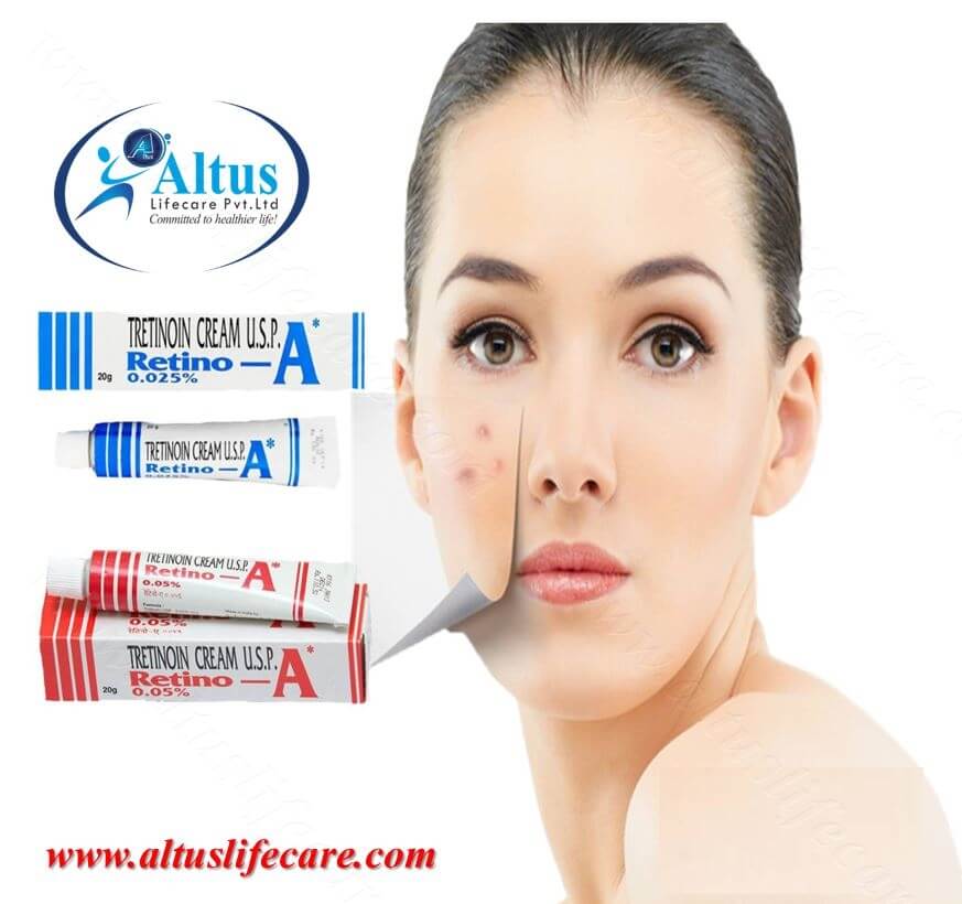 Tretinoin Cream for Anti-Aging, Acne and Wrinkles | Buy Online 0.025%, 0.05% and 0.1%