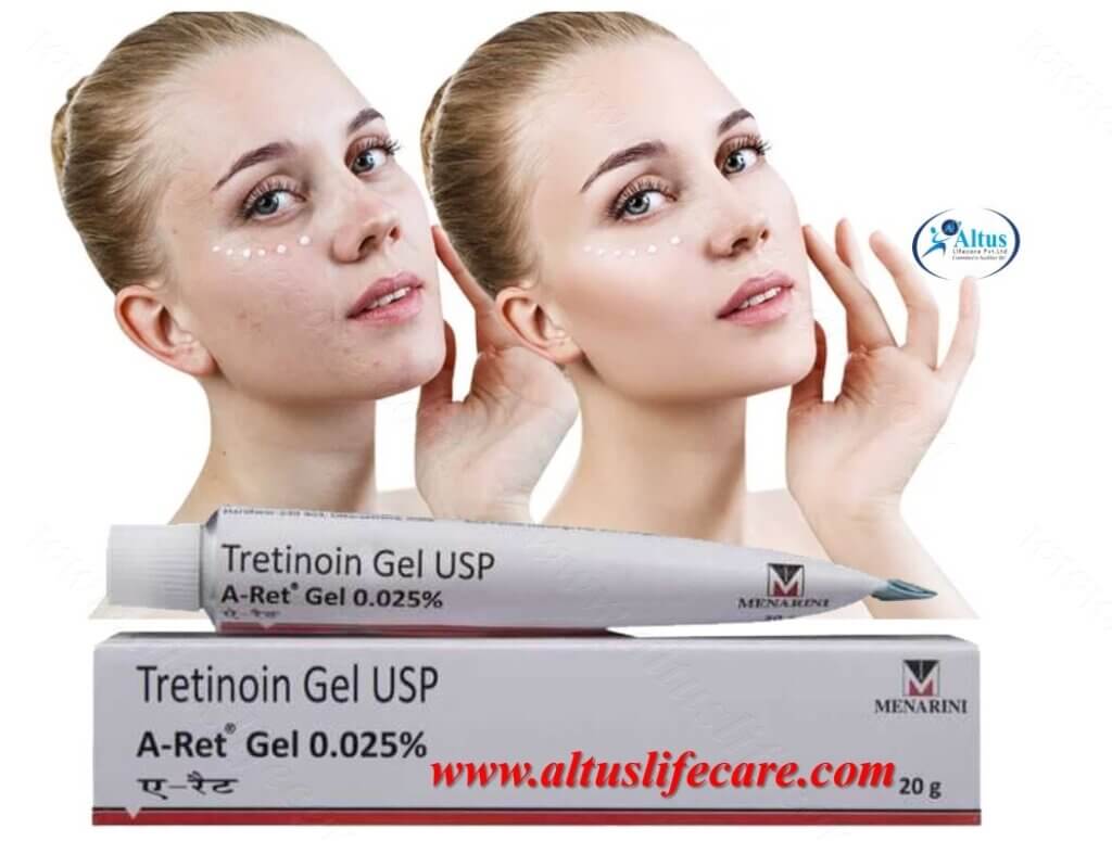 Tretinoin Cream for Anti-Aging, Acne and Wrinkles | Buy Online 0.025%, 0.05% and 0.1%